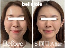 ベルジュワ(bellejoie)/