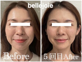 ベルジュワ(bellejoie)/