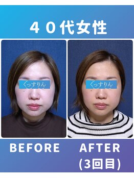 ぐっすりん/複数回継続のお客様の変化(9)