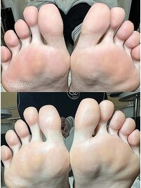 角質ふっとケア