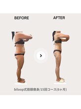 ビループ(biloop)/感動の結果をお見せします。