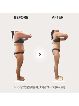 ビループ(biloop)/感動の結果をお見せします。