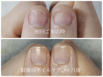 最強のネイルケア3ヶ月コース
