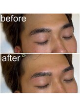 モテテ(motete)/お客様施術例アングル