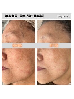 ラポール(rappore;)/リラクゼーションコース