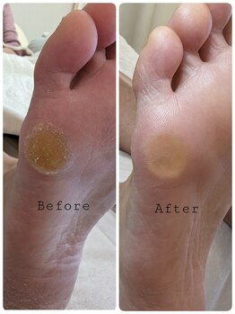 リゼラアンドコー 旭川店/before　after