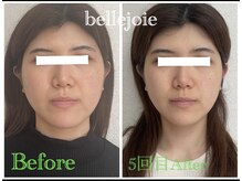 ベルジュワ(bellejoie)/