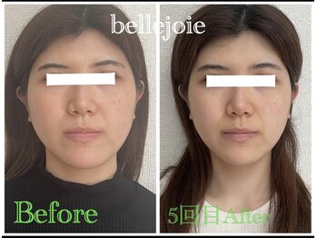 ベルジュワ(bellejoie)/