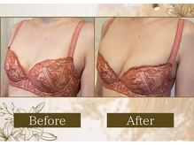 マリン(MARINE)/Before→After