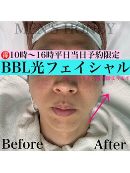 ハニーアイズ(Honey Eyes)/【BBLフェイシャル体験】