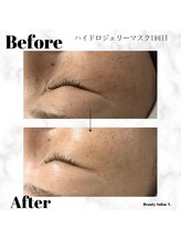 ワイドット(Y.)/小じわはどこえ？