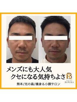 ブプラ 光の森店(BUPURA)/お客様ビフォーアフター