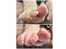 ネイル キシミー(Nail-Kishimi)