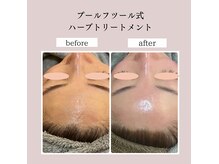 プールフツール(Pool Futur)の雰囲気（お顔の悩みを解決！美肌・年齢肌様々な肌悩みに対応します◎）