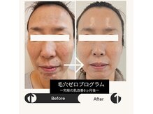 シンユウ(Shinyou)の雰囲気（【究極の美肌プログラム】何をやっても変わらなかった肌を改善へ）