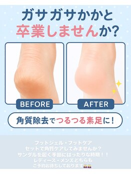 エムズスタイル ネイルバー(M's Style NAIL BAR)/足裏の角質ケア