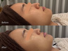 アウラ 小杉店(AULA)/