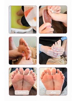 フット 角質除去コース