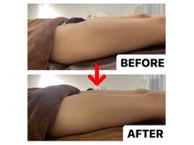 ブーケ/フェムケア　Before & After