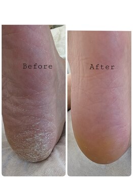 リゼラアンドコー 旭川店/before　after