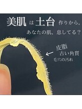 ワイドット(Y.)/脱毛で反応しない産毛アプローチ