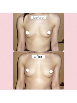 アップオー 小倉店(up・O)/体験者、様施術例