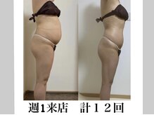 ウィズルーチェ つくばみどりの店(with luce)の雰囲気（全身痩身エステ120分コース12回3ヶ月【40代68kgだった方】）