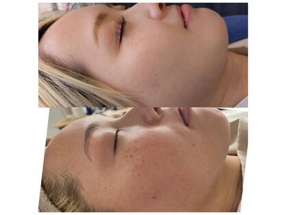 ソートトータルビューティーリッシュ(THOUGHT TOTAL BEAUTY Rish)の写真