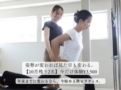 カリス(charis)の写真