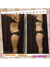 ビープロデュース 豊田店(B'PRODUCE)/beforeafter