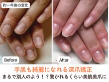 ネイルサロン プロムナード(nailsalon promnade)/爪が伸びないお悩み解消できます