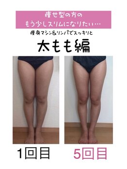 ピースツリー(PEACE TREE)の写真/実績重視のスタッフによるハンドテクニックで気になる箇所を徹底ケア！理想の美脚＆美尻に♪
個人差あり。