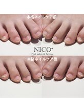 ニコプラス(NICO+)/足のお手入れできていますか？