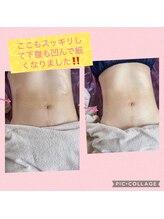 ブリアンジュ(B'riange)/痩身エステ くびれコース