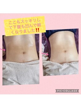 ブリアンジュ(B'riange)/痩身エステ くびれコース