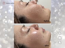 ノノサロン(nono salon)/