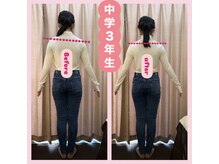 キララ 美容矯正/全身の歪み改善