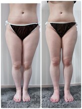 アイナ(aina)/お腹までスッキリ　美脚コース