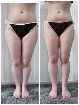 アイナ(aina)/お腹までスッキリ　美脚コース