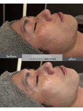 ケア(CARE)/男性フェイシャル