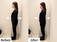 ソレア(Solea)/下っ腹・反り腰改善1回目