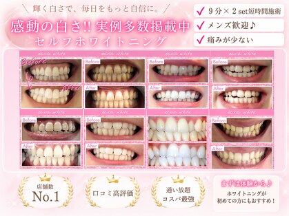 エクシアホワイトニング 調布店の写真