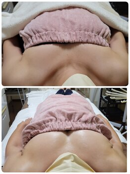 キミーエステティックサロン(kimmy esthetic salon)/バストトップは見せない施術!