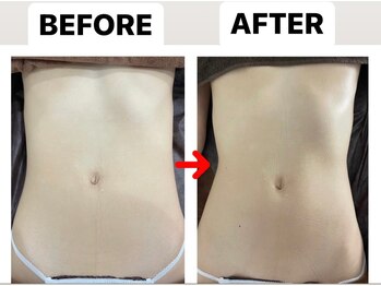 ブーケ/フェムケア　Before & After