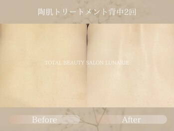 ルナージュ(LUNARJE)/陶肌トリートメントお背中コース