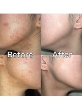 ハリオン 中目黒(HARI-ON)/お客様BeforeAfter