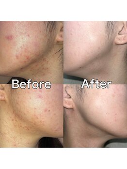 ハリオン 中目黒(HARI-ON)/お客様BeforeAfter