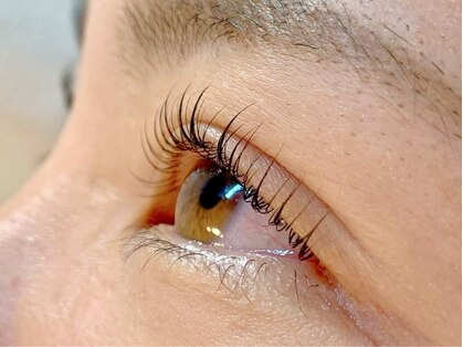 ダズル(DAZZLE)の写真