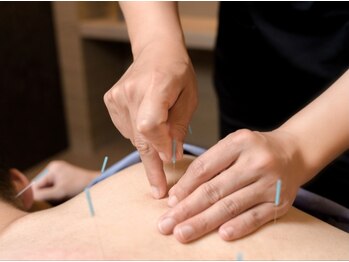 和美躰/丁寧で痛みの少ない鍼灸