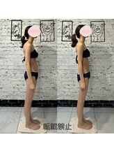 ザ レディービー(The Lady B)/ストレートネック改善